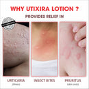 Utixira Lotion – Urticaria Relief Lotion