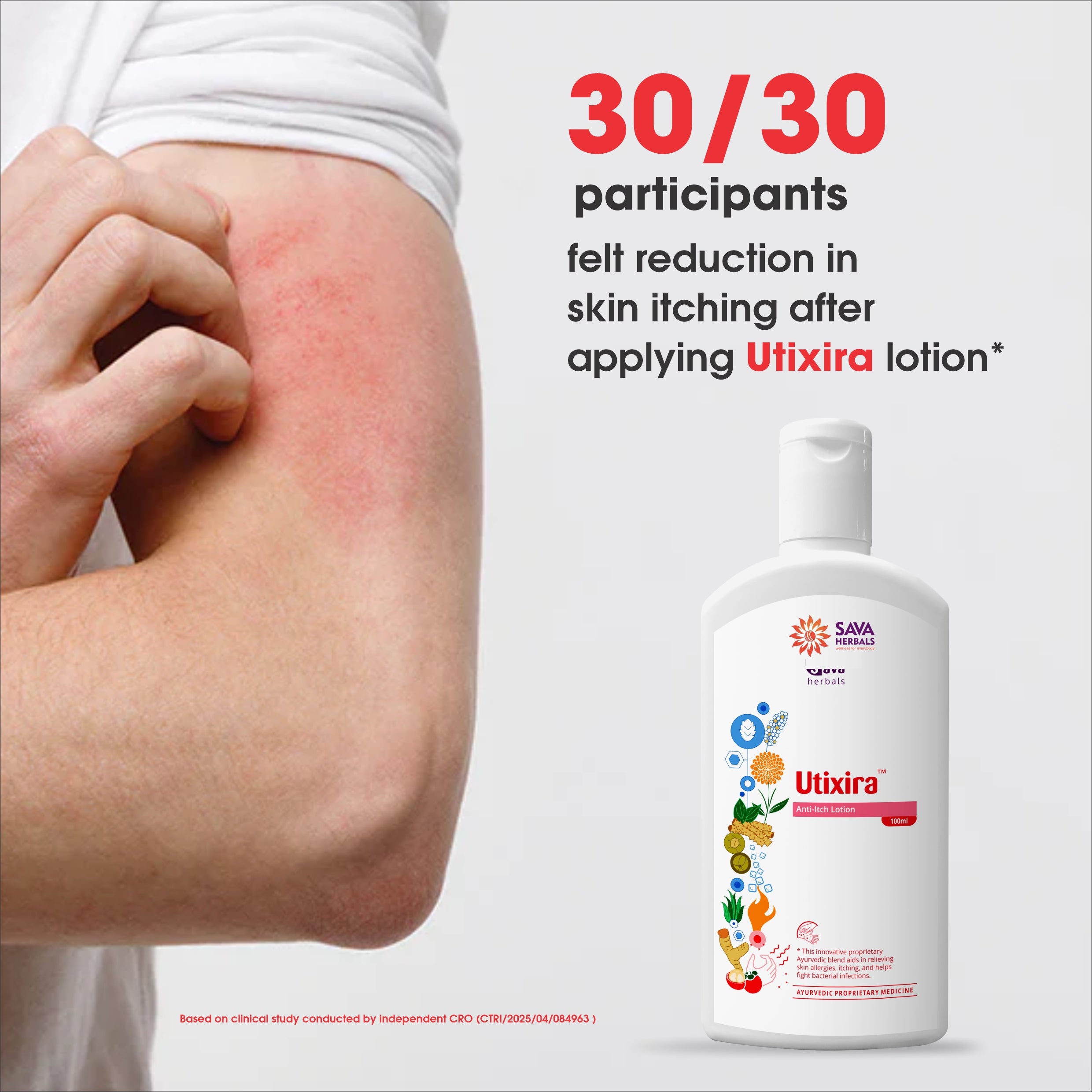 Utixira Lotion – Urticaria Relief Lotion