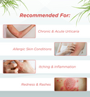 Utixira Tablets – Urticaria Relief