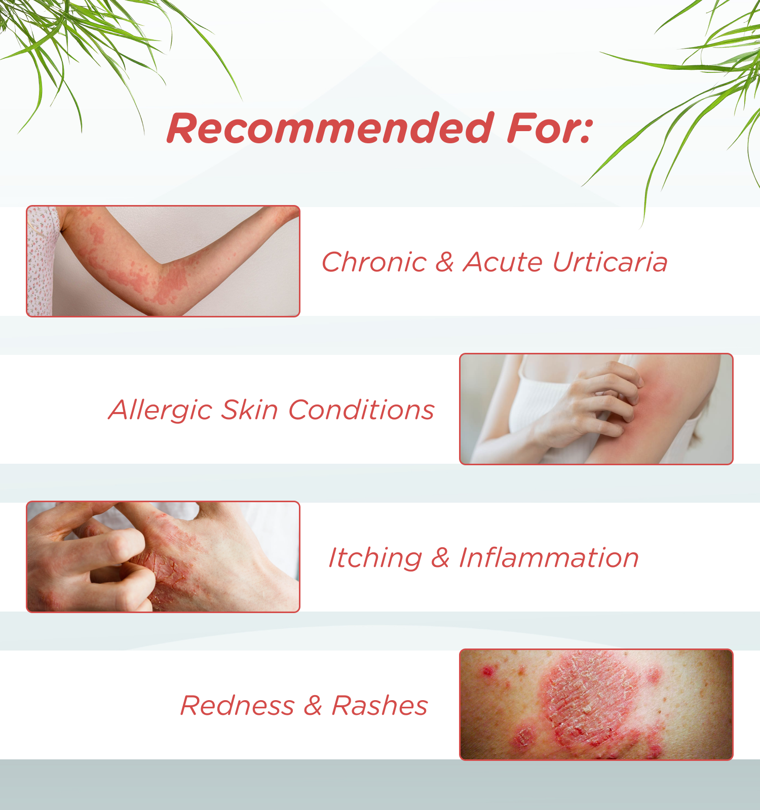 Utixira Tablets – Urticaria Relief